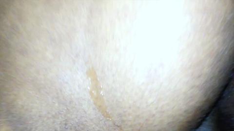 18515